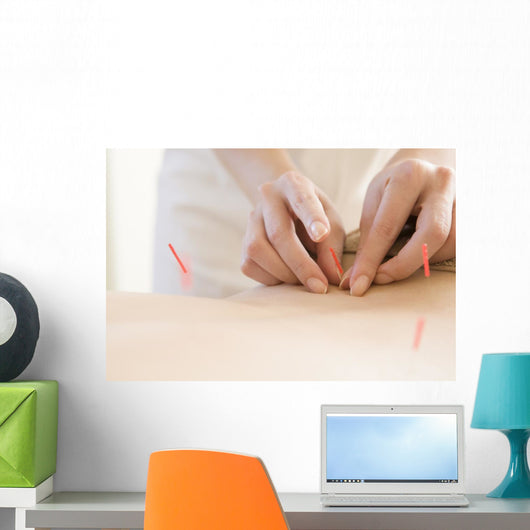 Women Undergoing Acupuncture Waist Wall Decal