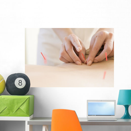 Women Undergoing Acupuncture Waist Wall Decal