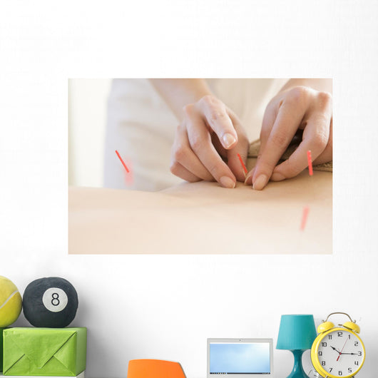 Women Undergoing Acupuncture Waist Wall Decal
