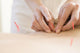 Women Undergoing Acupuncture Waist Wall Decal
