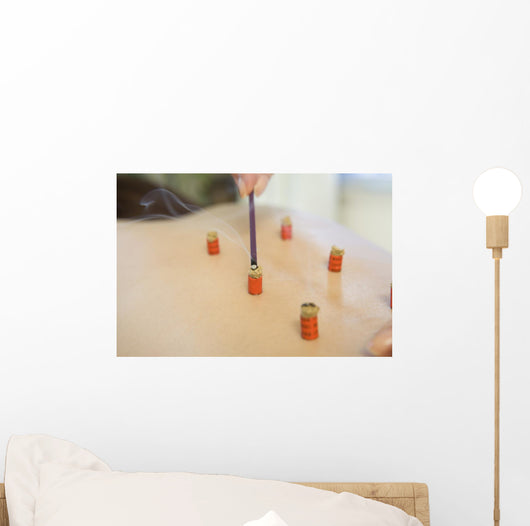 Moxibustion Treatment