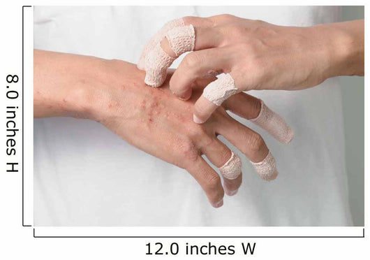 Itching caused by allergies, skin women. Wall Mural