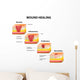 wound healing diagram Wall Decal