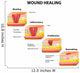 wound healing diagram Wall Decal