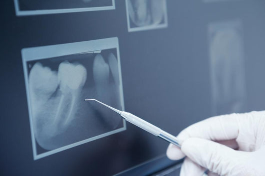 Gloved hand holding dental tool to teeth x-ray Wall Decal