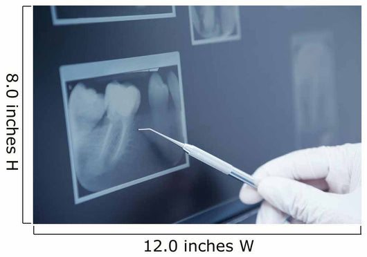 Gloved hand holding dental tool to teeth x-ray Wall Decal