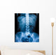 X-Ray scan human Wall Decal
