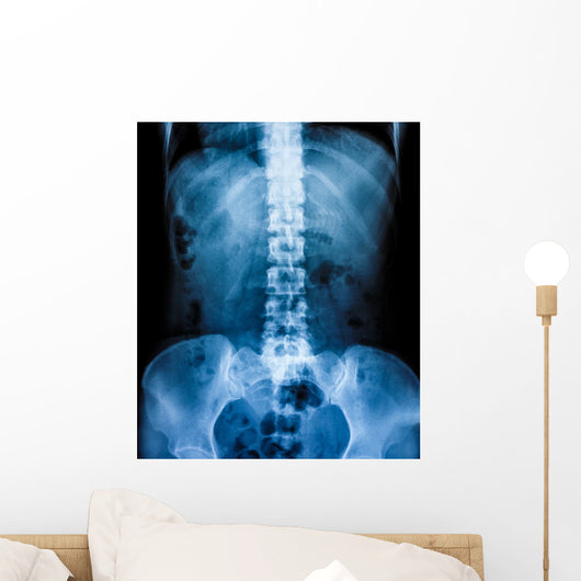 X-Ray scan human Wall Decal
