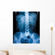X-Ray scan human Wall Decal