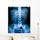 X-Ray scan human Wall Decal