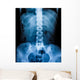 X-Ray scan human Wall Decal