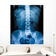 X-Ray scan human Wall Decal