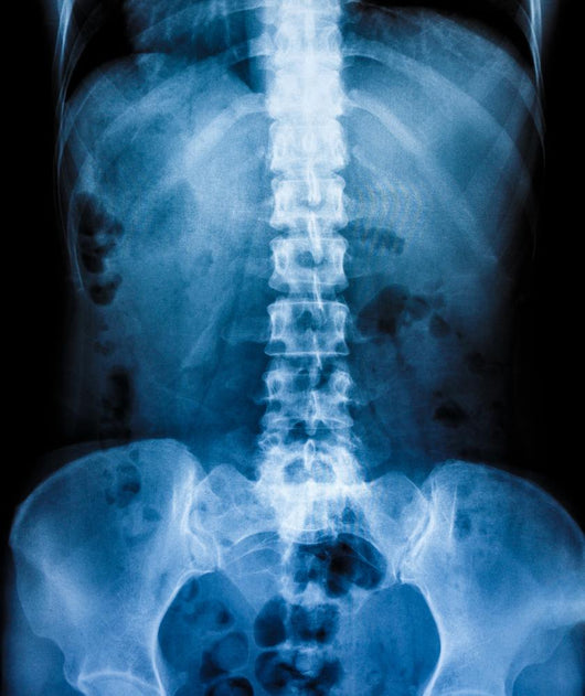 X-Ray scan human Wall Decal