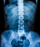 X-Ray scan human Wall Decal