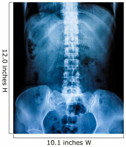X-Ray scan human Wall Decal