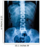 X-Ray scan human Wall Decal
