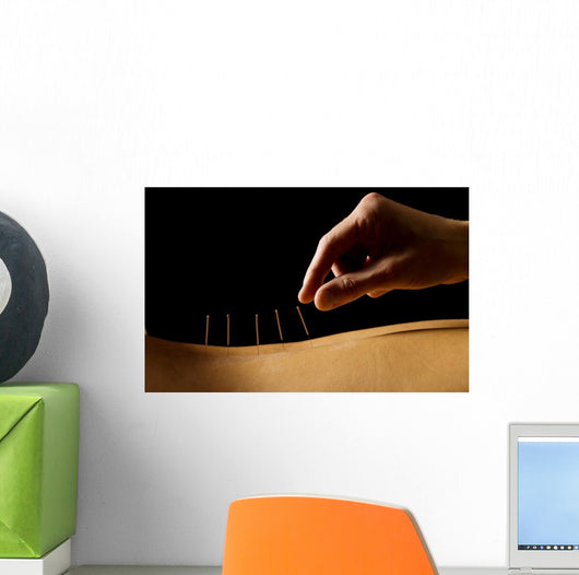 Acupuncture Wall Decal