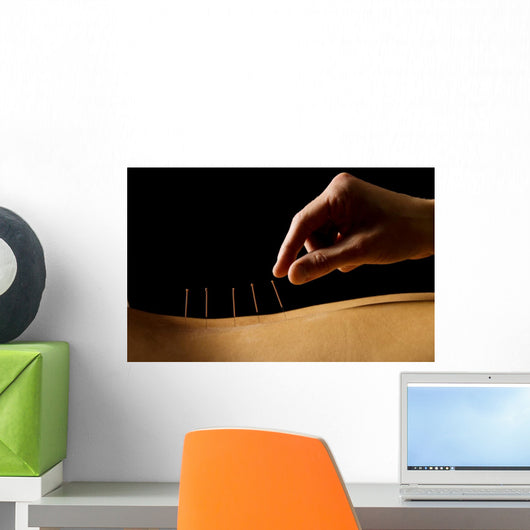 Acupuncture Wall Decal
