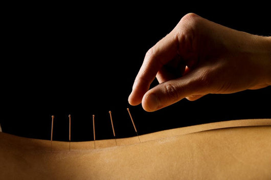 Acupuncture Wall Decal