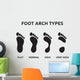 Foot Arch Types Wall Decal Sticker Set