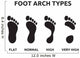 Foot Arch Types Wall Decal Sticker Set