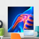 Shoulder Joint Anatomy Pain Wall Decal