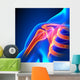 Shoulder Joint Anatomy Pain Wall Decal