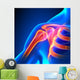 Shoulder Joint Anatomy Pain Wall Decal