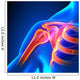 Shoulder Joint Anatomy Pain Wall Decal