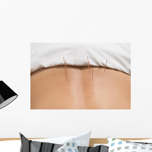 Akupunktur Wall Decal