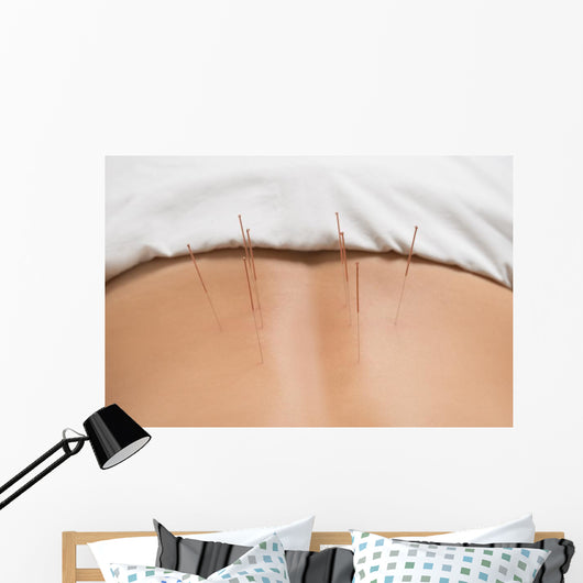 Akupunktur Wall Decal