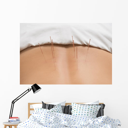 Akupunktur Wall Decal