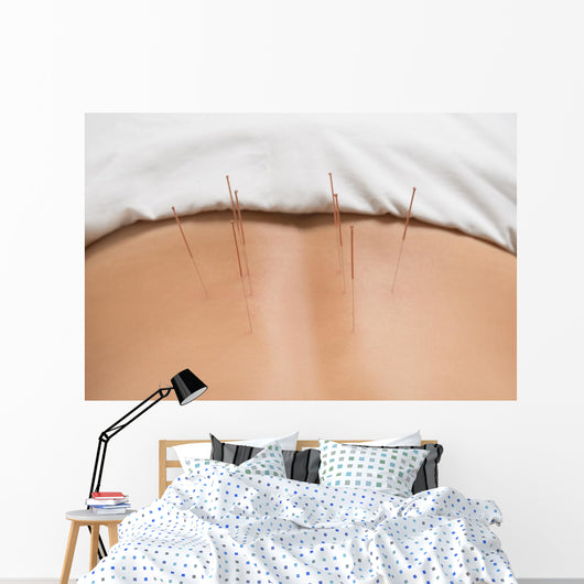 Akupunktur Wall Decal