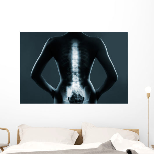Human backbone in x-ray Wall Mural