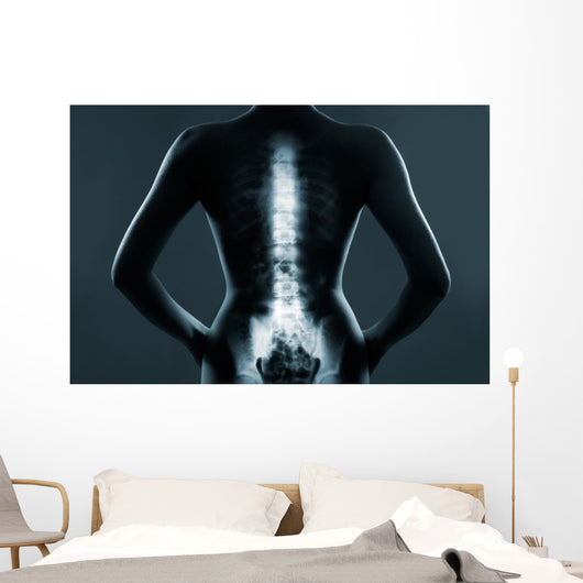 Human backbone in x-ray Wall Mural