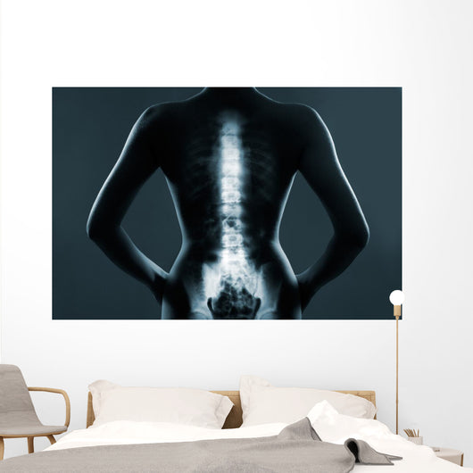 Human backbone in x-ray Wall Mural