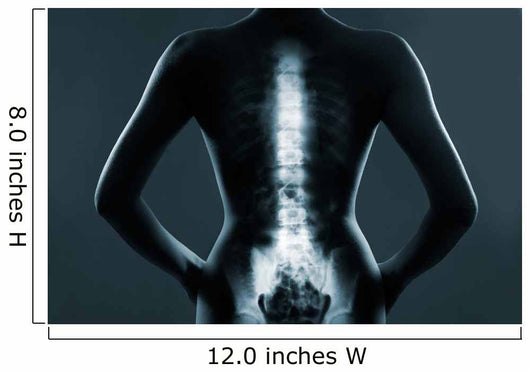 Human backbone in x-ray Wall Mural