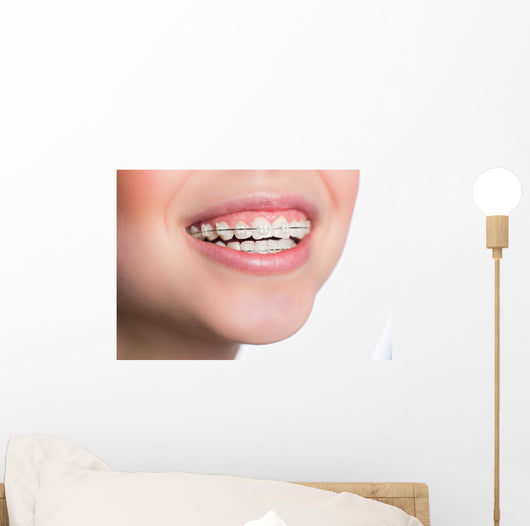 Woman with teeth braces Wall Mural