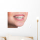 Woman with teeth braces Wall Mural