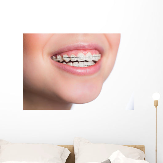 Woman with teeth braces Wall Mural