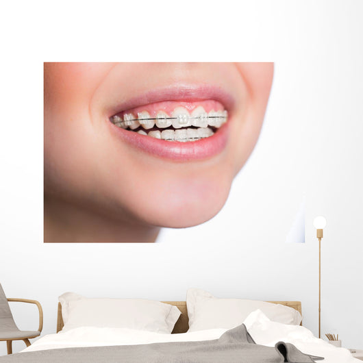 Woman with teeth braces Wall Mural
