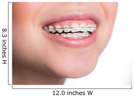 Woman with teeth braces Wall Mural