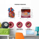 Blood Clot Formation Anatomy Wall Decal
