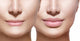 Before and after Lip Wall Decal Design 2