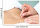 Acupuntura En El Abdomen Wall Decal Design 1