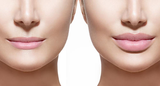 Before and after Lip Wall Decal Design 1
