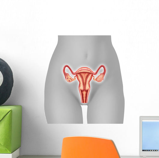 Illustration Female Uterus Wall Decal