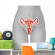 Illustration Female Uterus Wall Decal