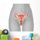 Illustration Female Uterus Wall Decal