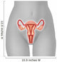 Illustration Female Uterus Wall Decal